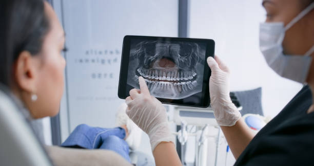 Licensed Wisdom Tooth Removal service in Ardmore, AL - Smile Center Dentistry